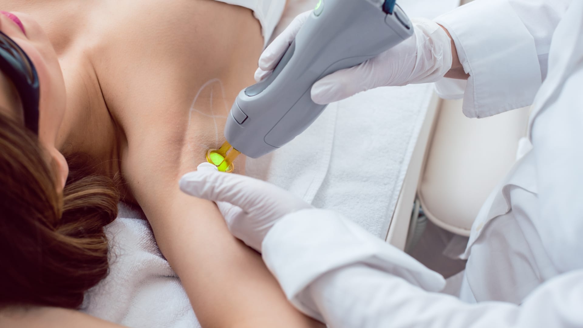 Epilation laser laser